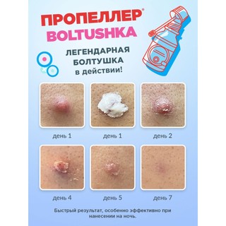 Huyền dịch chấm mụn Propeller - Kẽm chấm mụn Compliment