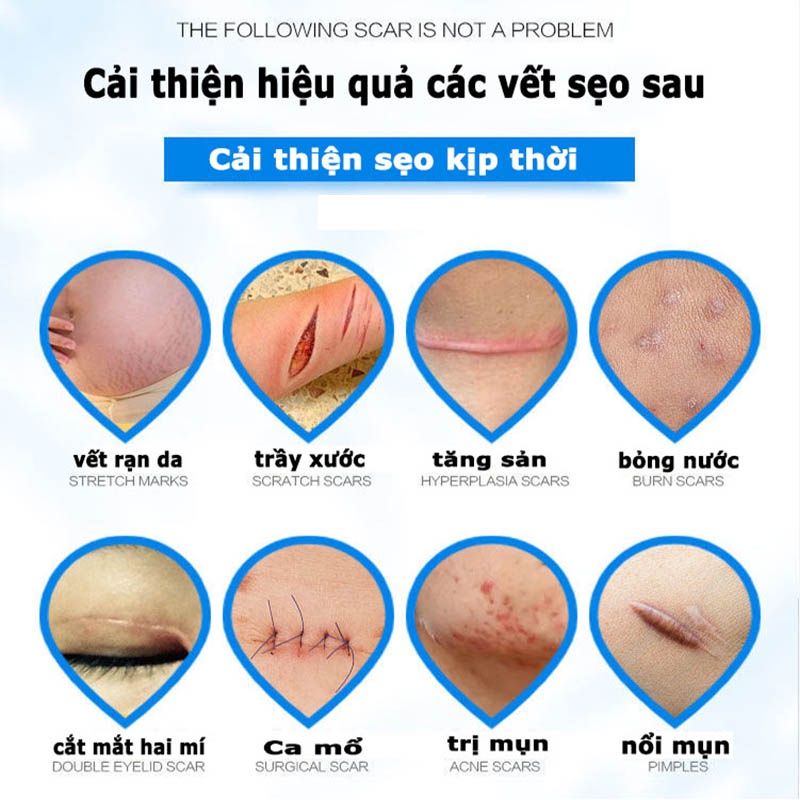 Scar Cream Scar Removal Kem sẹo sẹo lồi Loại bỏ sẹo Vết rạn da Làm mịn da Sửa chữa vết thương Vết sẹo phẫu thuật
