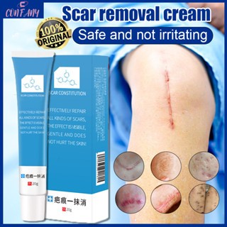Scar Cream Scar Removal Kem sẹo sẹo lồi Loại bỏ sẹo Vết rạn da Làm mịn da Sửa chữa vết thương Vết sẹo phẫu thuật