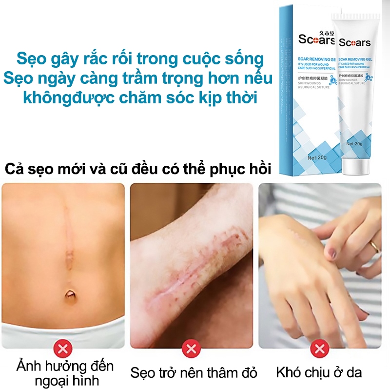 Gel bôi sẹo Kem bôi sẹo Loại bỏ các vết sẹo cũ Vết rạn Sẹo phẫu thuật Loại bỏ tận gốc các loại sẹo
