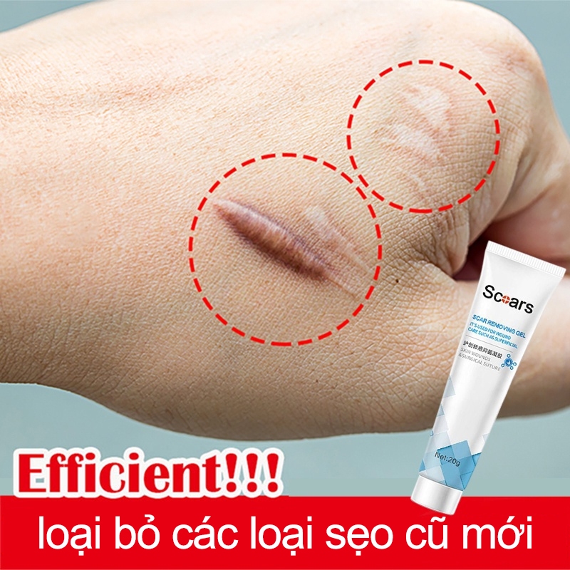 Gel bôi sẹo Kem bôi sẹo Loại bỏ các vết sẹo cũ Vết rạn Sẹo phẫu thuật Loại bỏ tận gốc các loại sẹo