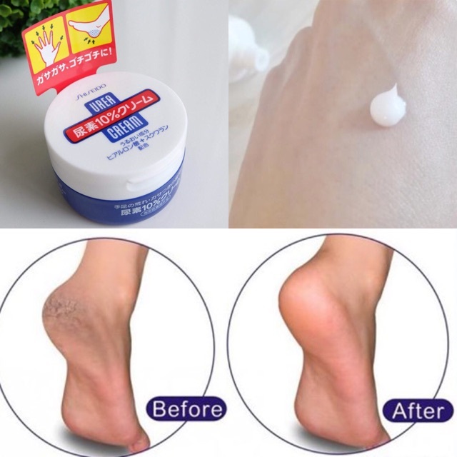 Kem nẻ gót chân Shiseido Urea Cream 100g Nhật Bản giúp dưỡng ẩm, mềm da giảm nứt nẻ chân tay