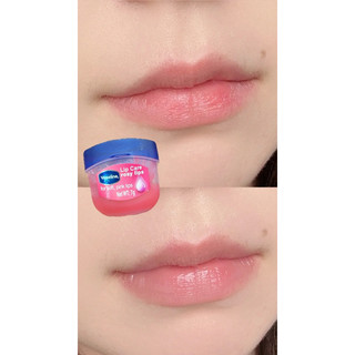 VASELINE SON DƯỠNG MÔI LIP THERAPY 7G