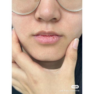 VASELINE SON DƯỠNG MÔI LIP THERAPY 7G