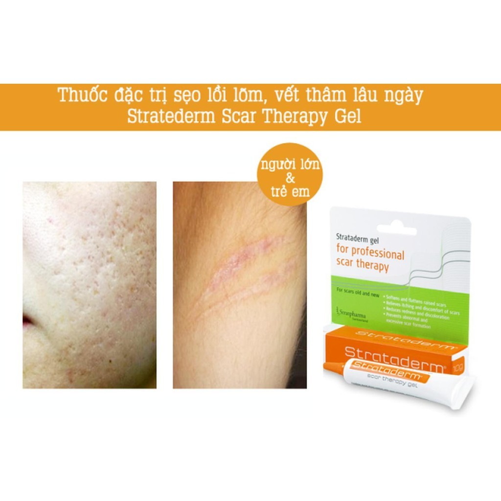 Strataderm - Gel Hỗ Trợ Làm Mờ Sẹo, Trắng Da, Mờ NámThụy Sĩ 10g
