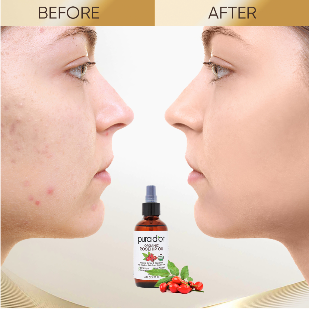 Dầu Hạt Tầm Xuân Hữu Cơ Rosehip Seed Oil PURA DOR Dưỡng Da, Giúp Mờ Thâm Sáng Da, Chống Lão Hoá 118ml