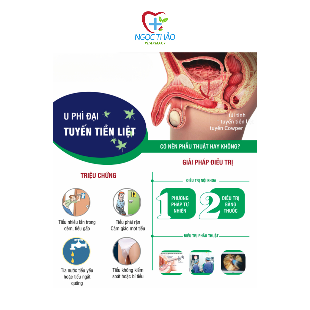 (DATE MỚI 11/2026) Vương Niệu Khang EUCARE giảm u xơ phì đại tuyến tiền liệt, tiểu đêm, bí tiểu - 50 viên