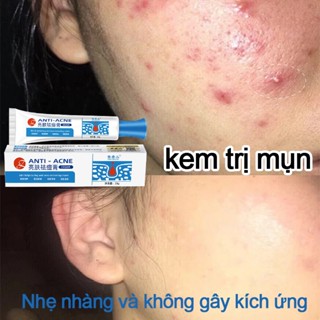 Kem trị mụn mụn dậy thì thâm mụn sửa chữa xóa mụn phục hồi làn da bị tổn thương do mụn kem chấm mụn 25g
