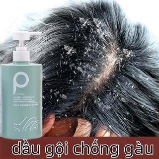 Dầu gội trị gầu dầu gội sạch gàu dầu gội muối biển dầu gội kiềm dầu giảm ngứa Sạch Gàu