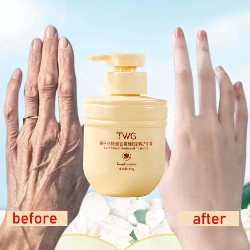 kem bôi tay dưỡng da kem bôi da 300g Dưỡng ẩm, làm trắng da, chống khô, nứt nẻ tay chân Có sẵn cho toàn bộ cơ thể