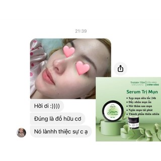 SERUM NGĂN MỤN NGỪA SẸO THÂM