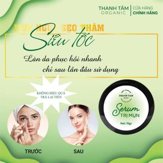 SERUM NGĂN MỤN NGỪA SẸO THÂM