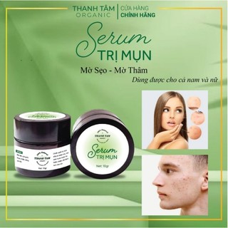 Serum ngăn mụn ngừa sẹo thâm