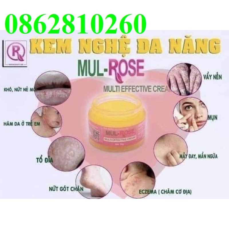 Kem nghệ đa năng mul rose mul-rose mulrose MUL-ROSE