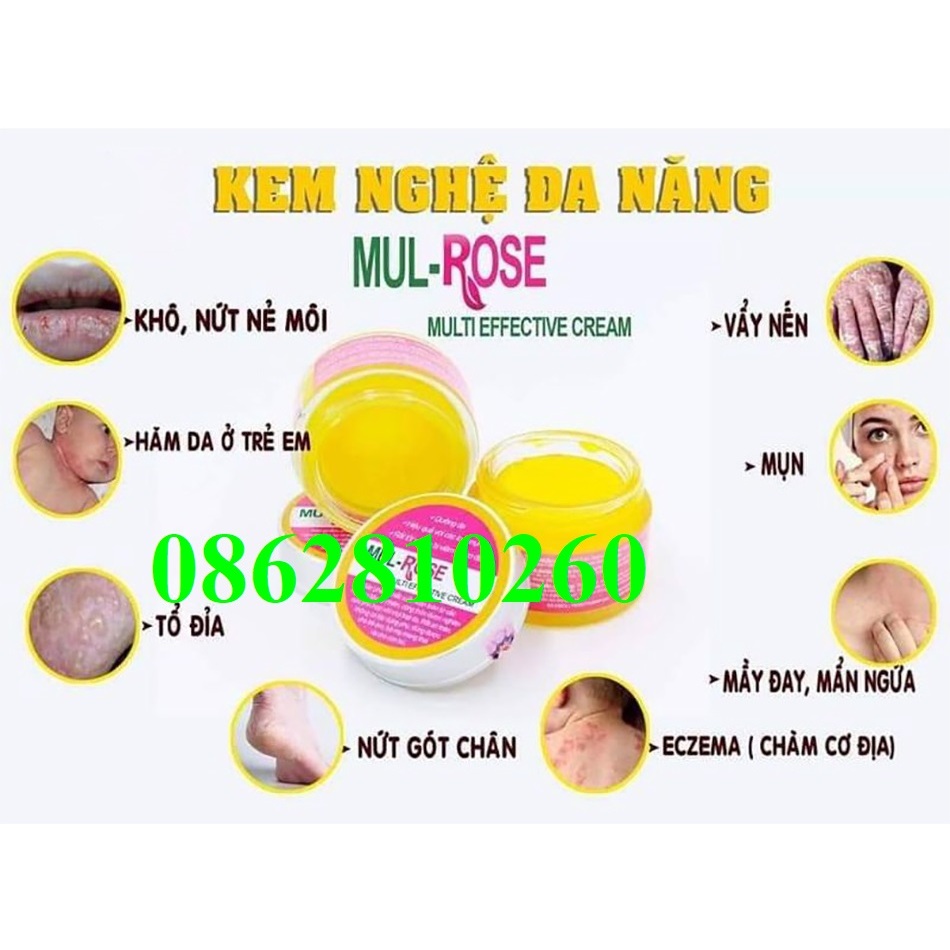 Kem nghệ đa năng mul rose mul-rose mulrose MUL-ROSE