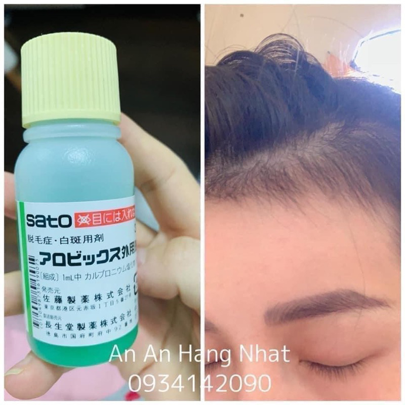 🌿🌿Thuốc mọc tóc thảo dược Sato Arovics Solutions 5% Nhật Bản