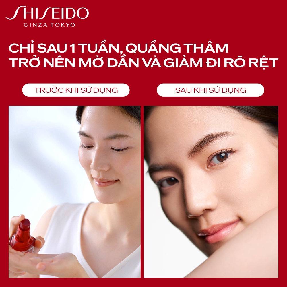 Tinh chất (serum) dưỡng mắt Shiseido Ultimune Power Infusing Eye Concentrate N 3.0 15ml