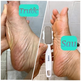 Chà gót chân Balea Đức - Nội địa Đức [Khuyến Mại]