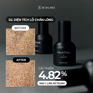 [NEW] Tinh chất se khít lỗ chân lông Black Core Ampoule 30ml