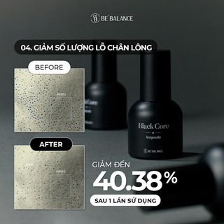 [NEW] Tinh chất se khít lỗ chân lông Black Core Ampoule 30ml