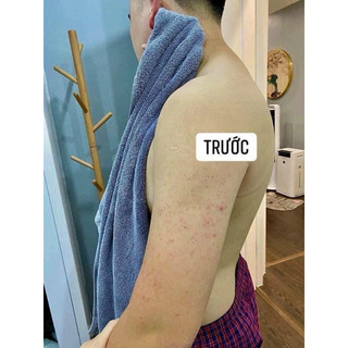 Kela lotion Thái lan 🇹🇭  ( chuẩn chính hãng)