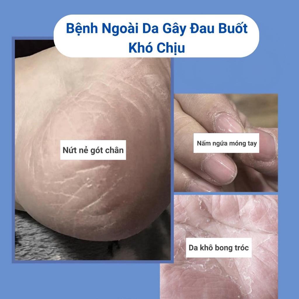 Kem Dưỡng Ẩm Chống Nứt Nẻ Gót Chân Tấm Thị, Kem Nứt Gót Chân Dạng Lăn Tiện Lợi Ngăn Ngừa Nứt Nẻ Da Tay Chân