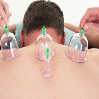 BỘ GIÁC HƠI 12 ỐNG KHÔNG DÙNG LỬA