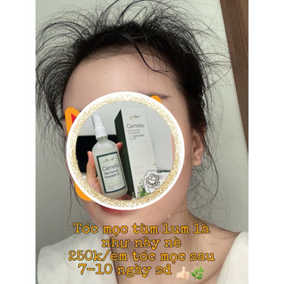 Combo 2 chai xịt kích mọc tóc Camellia 100ml