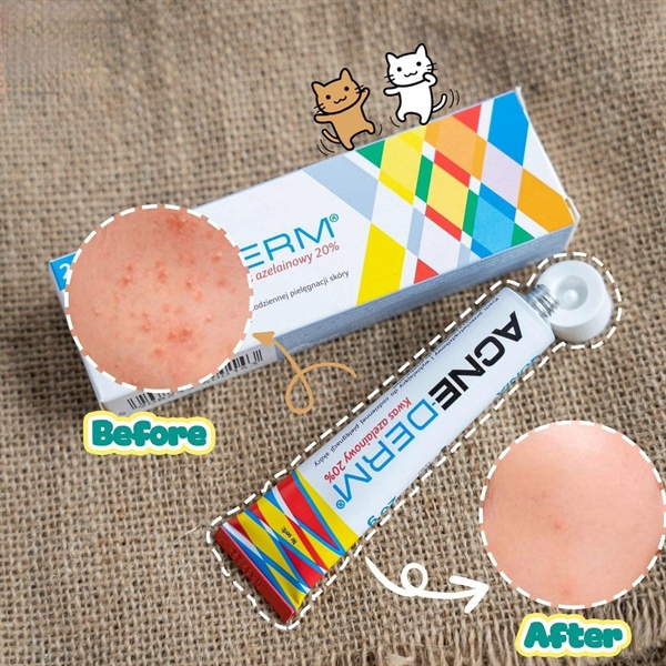 Kem giảm mụn Acne Derm, làm trắng da, mờ thâm 20g