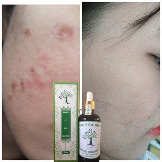 Tinh chất thảo mộc tái tạo da