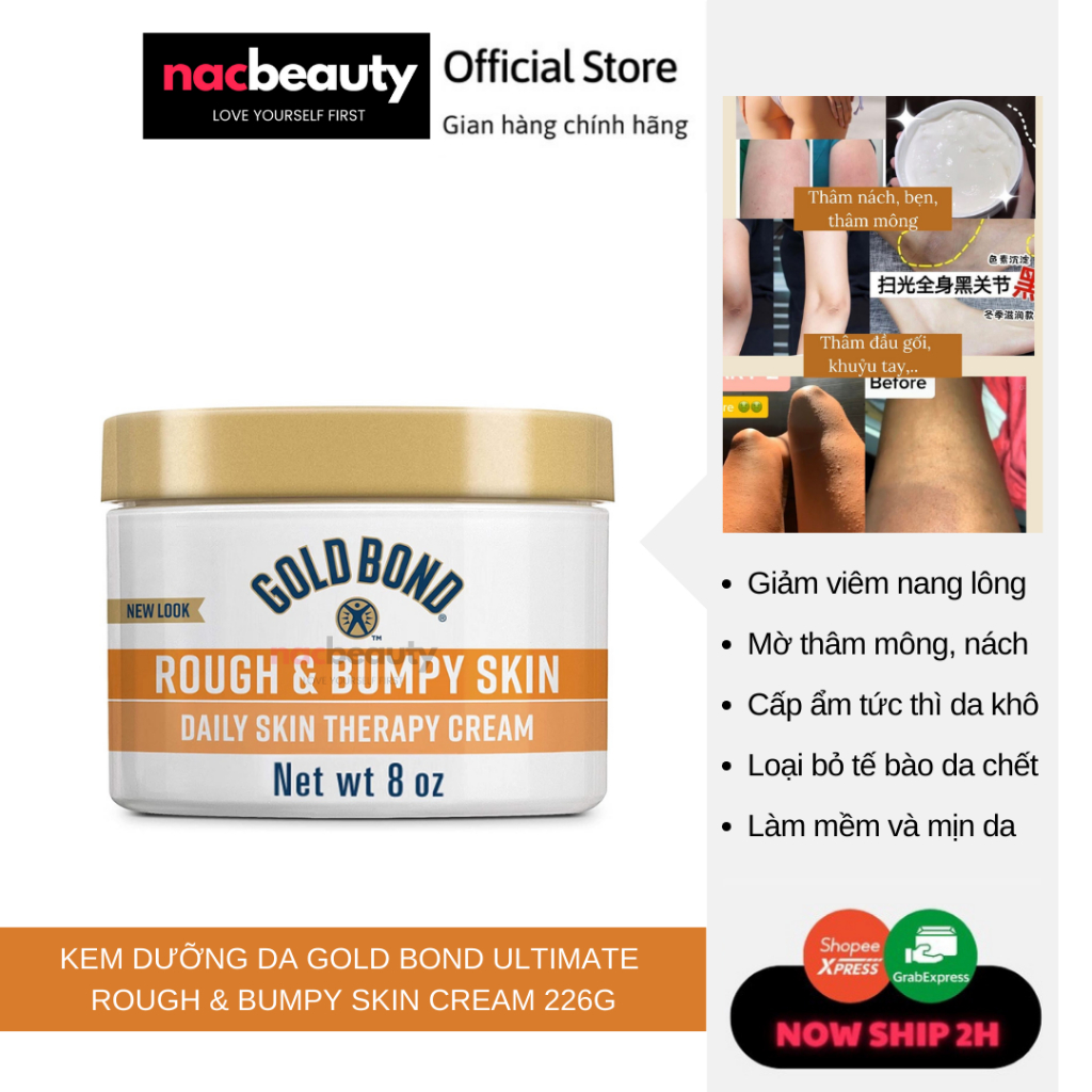 Kem dưỡng da Gold Bond Ultimate Rough & Bumpy Skin Cream 226G