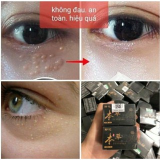 Kem bôi mụn thịt làm sáng vùng mắt nội địa Trung