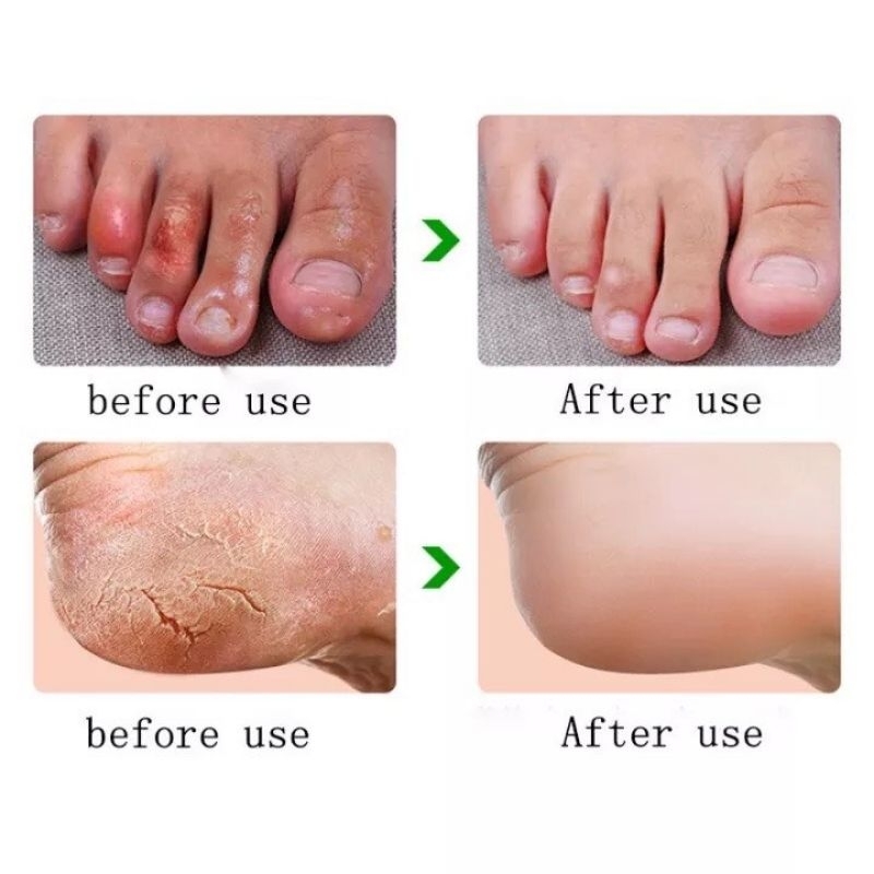 Kem Dưỡng Ẩm Tái Tạo Da ,Giảm Nứt Nẻ Bong Tróc Da ,Nứt Chân Tay~ Kem Ngựa Dưỡng Tay Chân 35gr