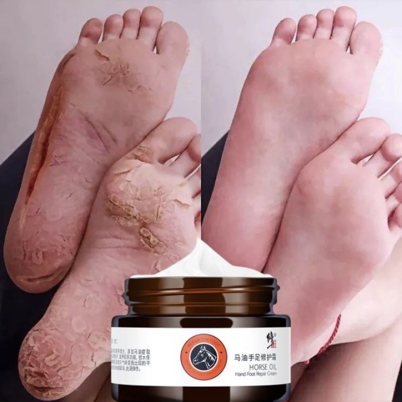 Kem Dưỡng Ẩm Tái Tạo Da ,Giảm Nứt Nẻ Bong Tróc Da ,Nứt Chân Tay~ Kem Ngựa Dưỡng Tay Chân 35gr