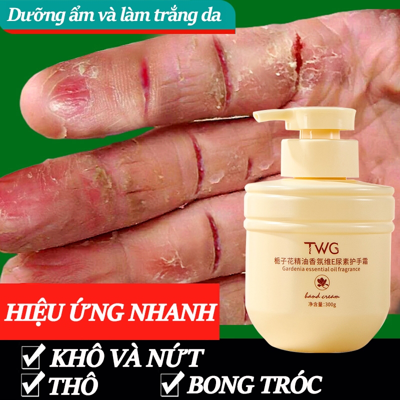 Kem dưỡng da tay Dưỡng ẩm da tay Kem làm trắng tay 300g Dưỡng ẩm, làm trắng da, chống khô, nứt nẻ tay chân, dưỡng da tay