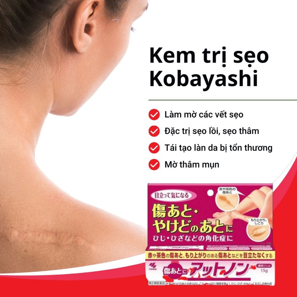Kem bôi mờ sẹo Ex Kobayashi hỗ trợ làm sáng da, mờ thâm mụn, sẹo lồi, sẹo rỗ nội địa Nhật Bản 15g