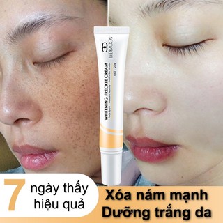  Kem nám tàn nhang và loại bỏ đốm kem dưỡng trắng da mặt 20g làm sáng trắng da chống lão hóa nhanh chóng 