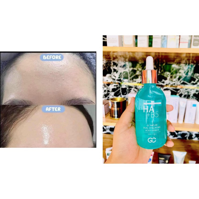 Serum Cấp Ẩm Phục Hồi Da HA + B5 GC Natural Dual Hyaluronic Acid Essence 100ml Hàn Quốc