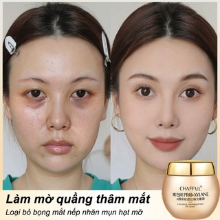Kem dưỡng mắt kem chống lão hóa vùng mắt dưỡng thâm mắt 60g Giảm quầng thâm xóa nếp nhăn và bọng mắt chăm sóc mắt