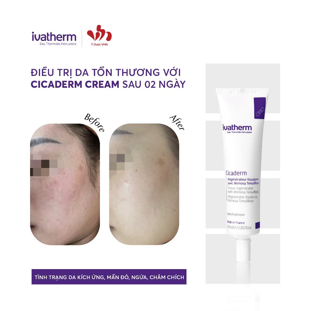 [Mã INBAU404 giảm 40K đơn 249K] Kem tái tạo da ngăn ngừa sẹo ivatherm cicaderm cream - IVATHERM