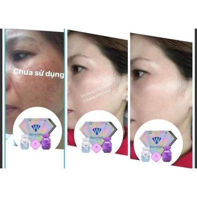 Viên uống trắng da Diamond white chính hãng, trắng da, mờ nám tàn nhang