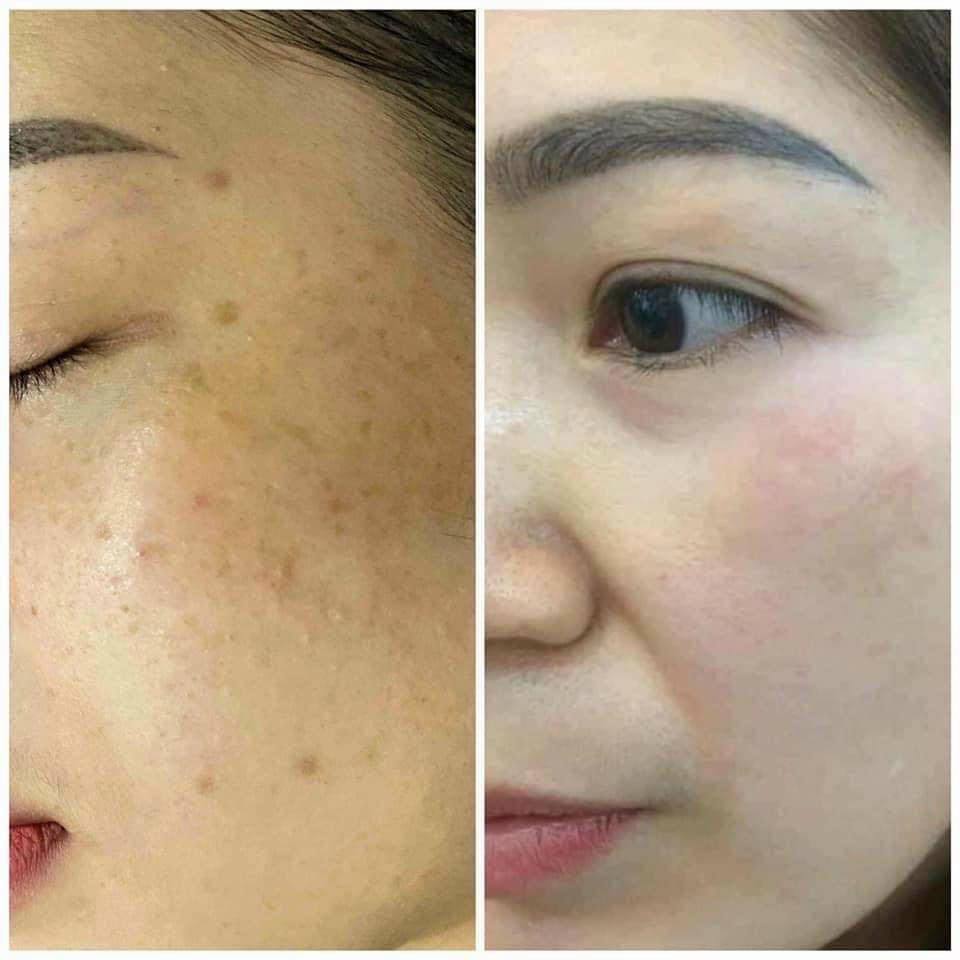 Viên uống trắng da Diamond white chính hãng, trắng da, mờ nám tàn nhang