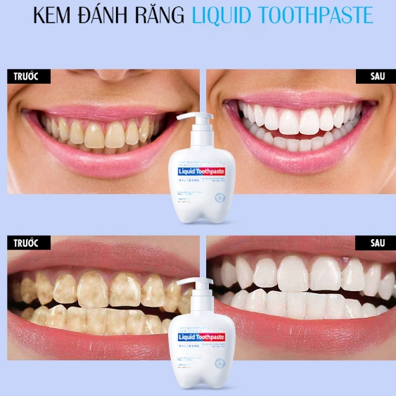 Kem đánh răng dạng lỏng Liquid Toothpaste GUANGHE 200g giúp giảm ê buốt hiệu quả và làm trắng răng