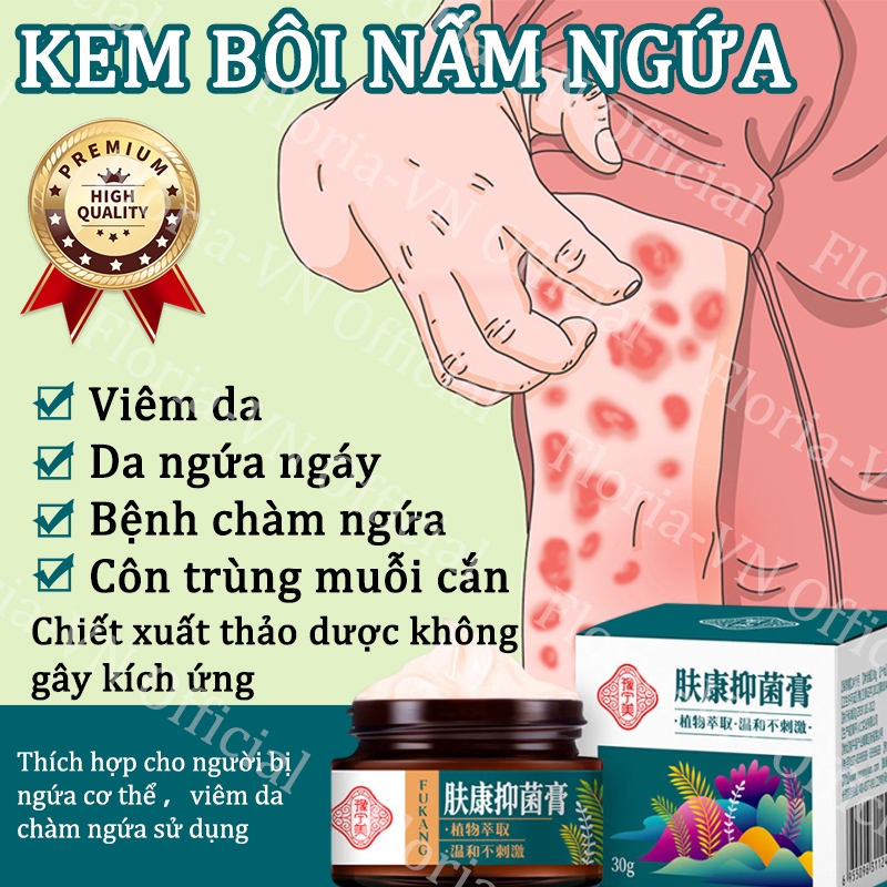 Kem bôi nấm ngứa Kem giảm ngứa 30g Dịu nhẹ Nhanh chóng Kháng khuẩn giảm ngứa Lang ben Bệnh chàm ngứa Vảy nến