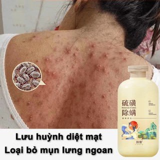 sữa tắm trắng da sữa tắm mụn lưng sữa tắm lưu hương 500ml Làm sạch sâu làm trắng dưỡng ẩm loại bỏ mụn trứng cá