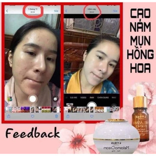 [CAM KẾT CHÍNH HÃNG]Cao nám hồng hoa lodas Đan Thy