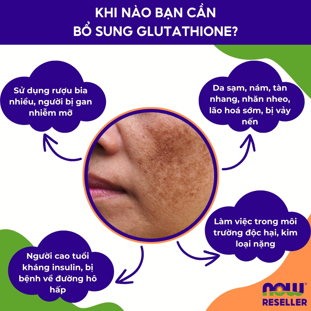 Glutathione hỗ trợ trắng da, thải độc NOW 500mg giúp mờ nám, tàn nhang, da trắng hồng 60 viên
