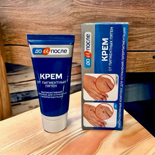 Kem ngừa, giảm Đồi Mồi Đốm Nâu Da Tay Kpem Hàng Nga (50ml)