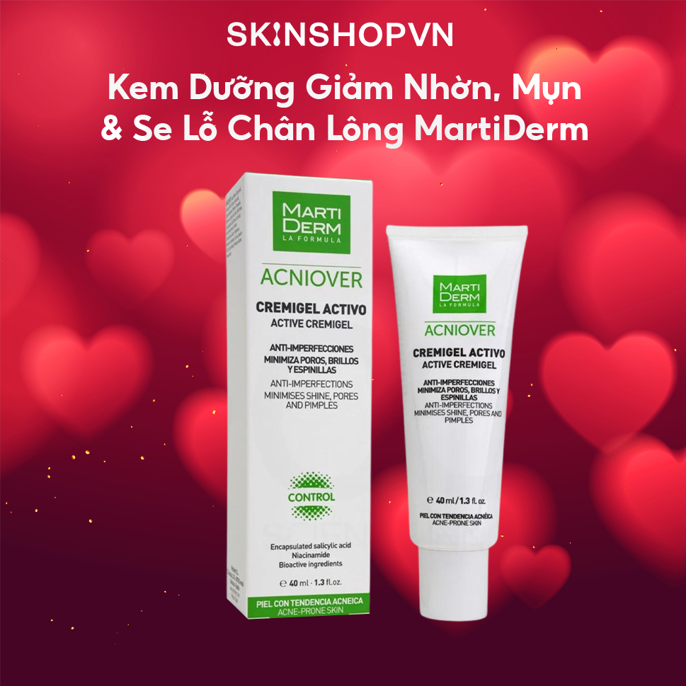 Kem Dưỡng Giảm Nhờn, Mụn & Se Lỗ Chân Lông - MartiDerm Acniover Active Cremigel (40ml)