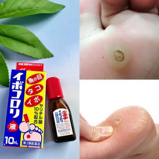 Dung dịch bôi ngoài da ngừa chai sần IBOKORORI 10ml